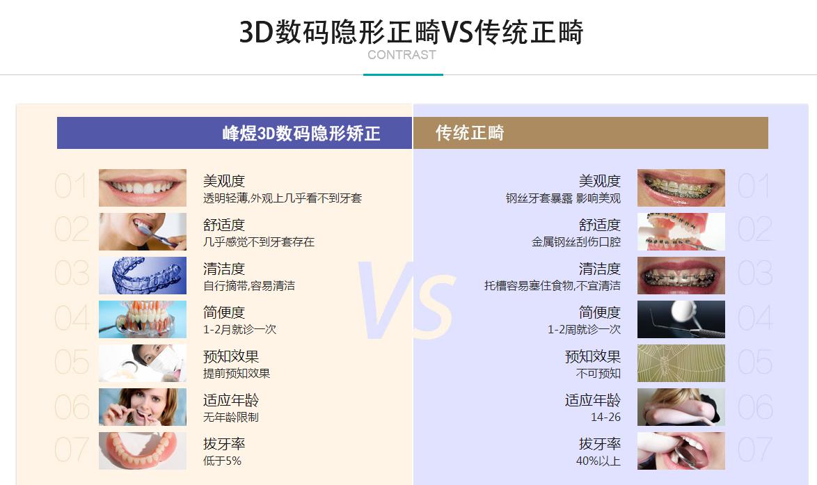 DSD